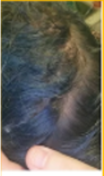 Cynthia after hair treatment