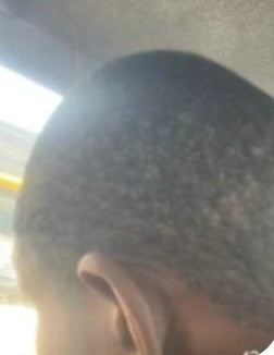 Mamadou after hair treatment