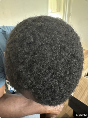 Ulrich after hair treatment