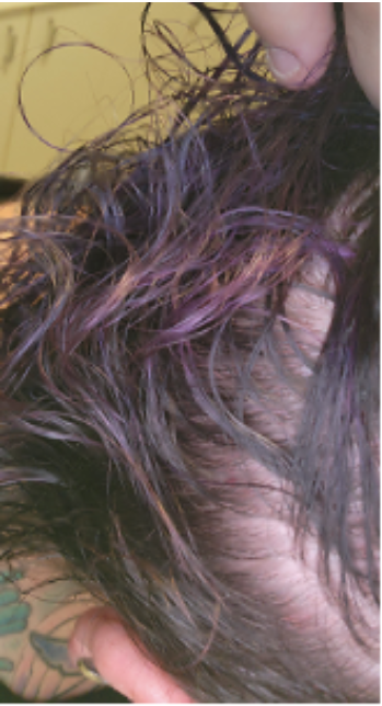 Cynthia before hair treatment