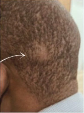 Mamadou before hair treatment