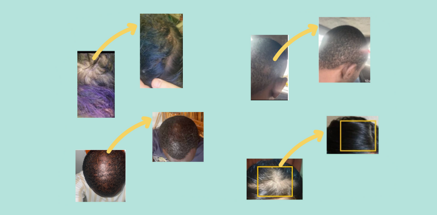 Your Treatment Journey