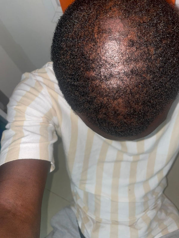 Ousseynou before hair treatment